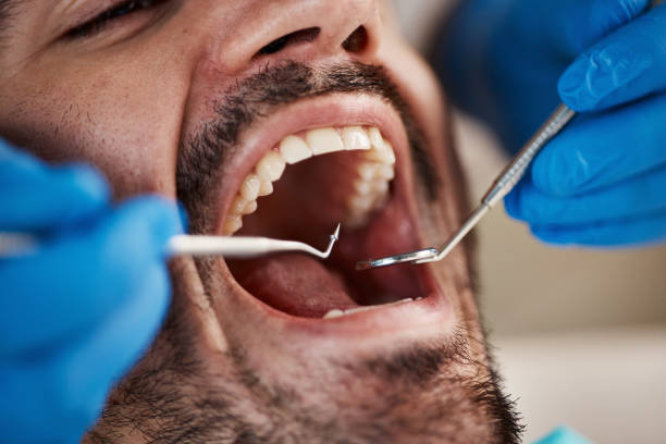 Best Emergency Broken Tooth Repair in Fairchance, PA