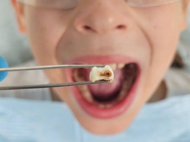 Best Pediatric Emergency Dentist in Fairchance, PA